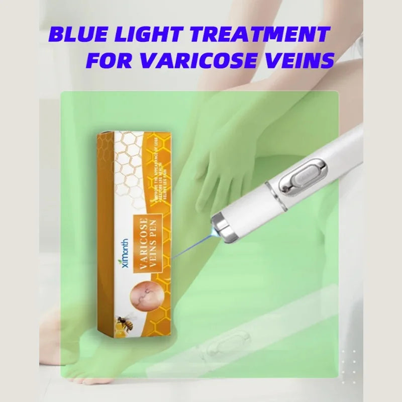 Favolux™ Lampshade Therapy Varicose Veins Legs Effective Relief Of Dilated Vasculitis Phlebitis Health Improved Blood Circulation